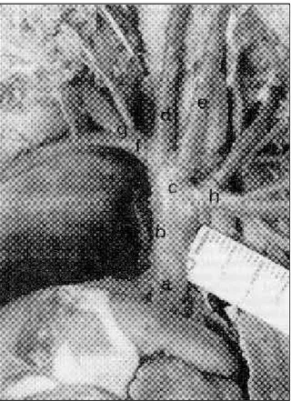Figura 2 - Fotografia indicando os ramos do arco aórtico de um feto de búfalo: Arco aórtico (a), Tronco  braquiocefáli-co (b), Tronbraquiocefáli-co bicarotídeo (c), Artéria carótida braquiocefáli- co-mum direita (d), Artéria carótida coco-mum esquerda (e),