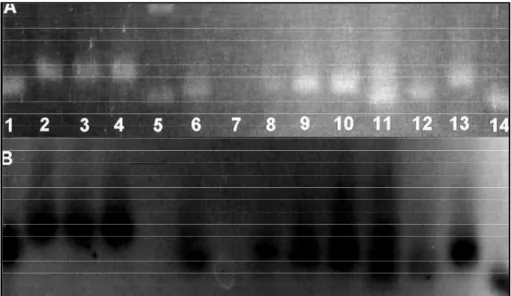Fig 2. Molecular study based on the PCR technique showing pictures of the gel (A) and of the X-ray film obtained after autoradiography (B)