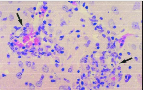Fig 1. Microgranulomas (arrows) in the brainstem 75 days after E. cuniculi inoculation