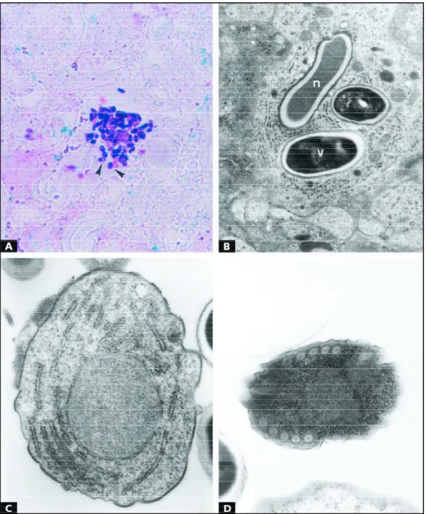 Fig 3. Proliferative forms and spores of E. cuniculi from mice immunosuppressed with CY