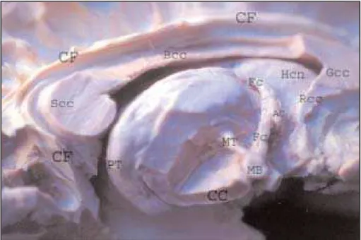 Fig 5. Medial aspect. CF, cingulate fascicullum; Rcc, rostrum of corpus callosum; Gcc, genu of cc; Bcc, body of cc; Scc, splenium of corpus callosum; PT, pulvinar thalamus; CC, crus cerebri; MT, mamilothalamic fascicullum; MB, mamilar body; Fc, fornix (col