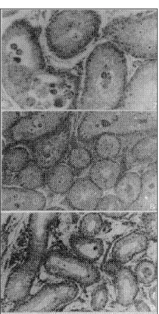 Figura 4 - Fotomicrografias de testículos submetidos à clampa- clampa-gens do cordão espermático por 2:00h e 15 e 2:00h e 30, fotomicrografias 7, 8 e9