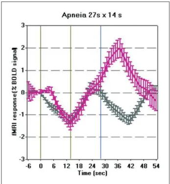 Fig 2. Statistical map of BOLD signal change induced by breath holding. (a) 14s and (b) 27s