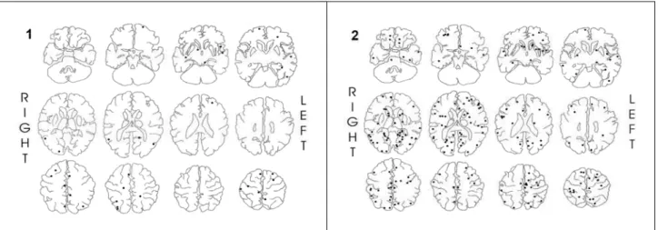 Figs 3 and 4. Examples of patients without a relationship between the localization and number of intracranial calcifications and the type and severity of epilepsy