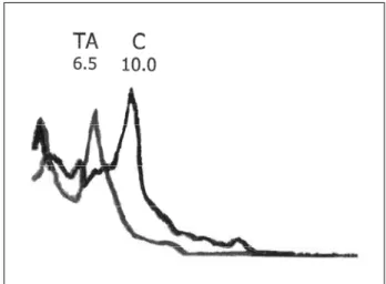 Table 3. Correlations between peak of frequency and time of thinner consumption in thinner abusers (n=22).