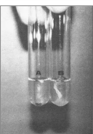 Figura 1 – Esfregaço do sedimento de líquido sinovial de eqüinos corado por panótico (x312).