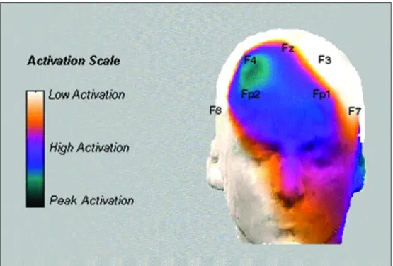 Fig 2. Illustrates sites of lower and higher activations in the alpha range after sleep deprivation