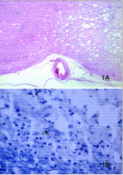 Fig 1. 21 days lesion from a group 2  rat  within  the  pons.  A.  Many round-nuclei glial cells are observ e d in this rather compact demyelinat  -ed lesion