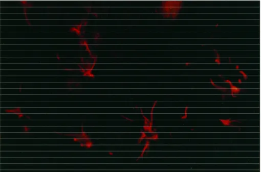 Fig 2. Large broadly branched OSP- OSPi m m u n o f l u o rescent olOSPigodendro  -cytes from the periphery of the lesion in Fig 1, 400X.