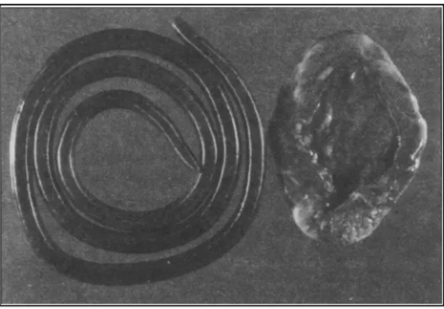 Figura 1 - Espécime fêmea de Dioctophyma renale (à esquerda) e rim direito. O parasita tem coloração avermelhada e mede 73cm de comprimento