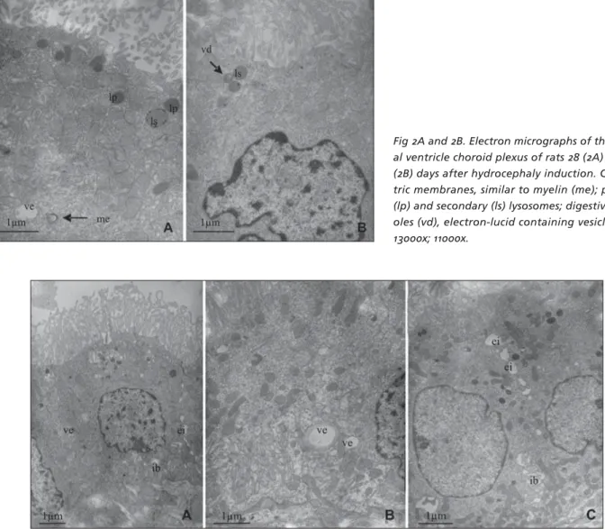 Fig 2A and 2B. Electron micrographs of the later- later-al ventricle choroid plexus of rats 28 (2A) and 35  (2B) days after hydrocephaly induction