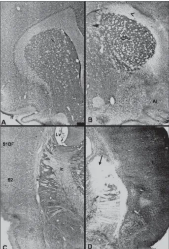 Fig 3. Photomicrographs of coronal sections of the brain of the  same rat passing through the corpus striatum at a more  crani-al (A and B) and more caudcrani-al (C and D) level