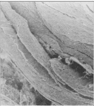 Figura 3 - Fotomicrografia  de corte histológico do tendão calcâneo canino submetido à tenoplastia com  peri-tônio bovino aos 120 dias de pós-operatório,  evi-denciando o peritônio (seta) envolto por denso  teci-do conjuntivo colagenizateci-do com disposiç