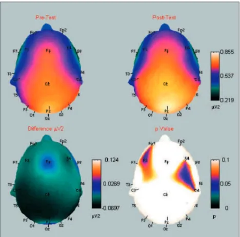 Fig 2. Beta absolute power cortical map  showing the energy shift from the pre  to the postexercise moment