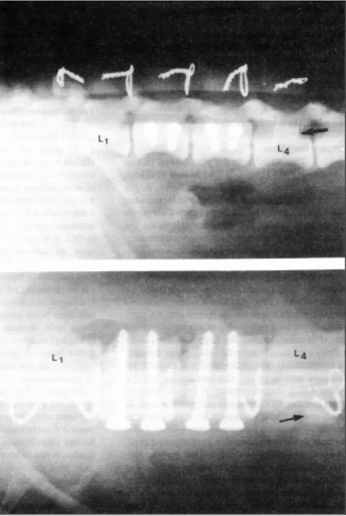 Figura 1 – Radiografias lateral e ventro-dorsal da coluna vertebral lombar de cão. Placa de PVC fixada com 4 parafusos nos corpos vertebrais L 2  e L 3  e duas placas, fixadas com fio