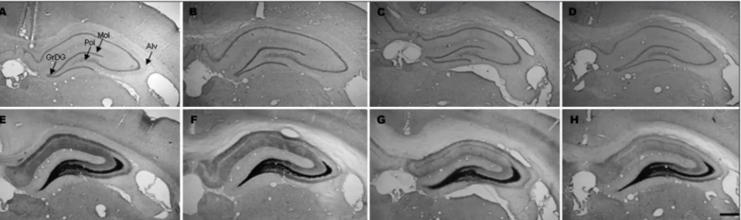 Fig 4. The hippocampal cytoarchitecture, visualized using Nissl staining (A to D) and the hippocampal mossy ibers, visualized by Neo-Timm  technique (E to H), during adult life
