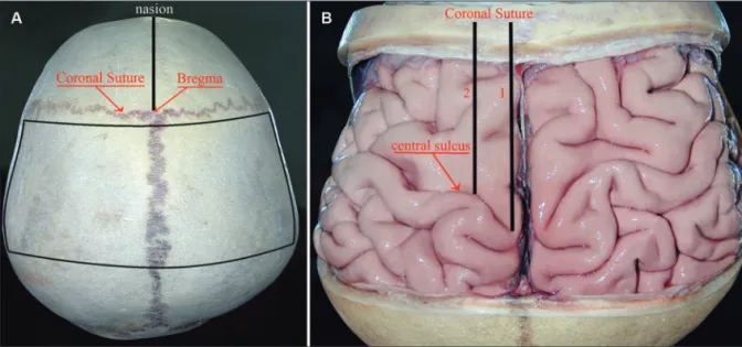 Table 1. Coronal suture and sulcal points related measurements.