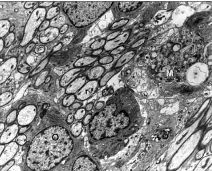 Fig 4. Oligodendrocytes (O) at the periphery of the lesion  close to groups of remyelinating axons (r)