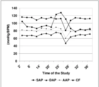 Fig 3. Tilt-table test; SAP, systolic arterial pressure; DAP, diastolic ar- ar-terial pressure; AAP, average arar-terial pressure; CF, cardiac frequency.