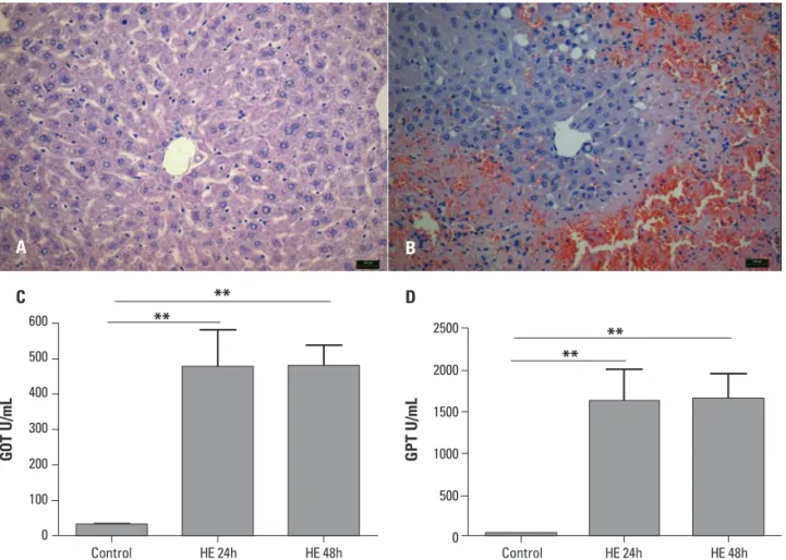 Fig 3.  Liver damage following injection of 600 mg/kg of thioacetamide. Histological section (5 µm) of liver from con- con-trol mice (n=3) with normal portal triad and hepatocytes [A]