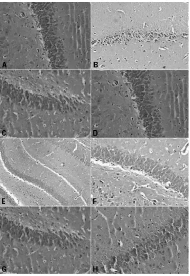 Fig 2. Histopathological alterations in rat hippocampus treated  with pilocarpine, atropine, α-tocopherol or their combinations