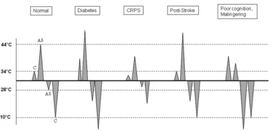 Fig 1. The most common quantitative sensory testing abnormalities in diferent clinical conditions 8 .