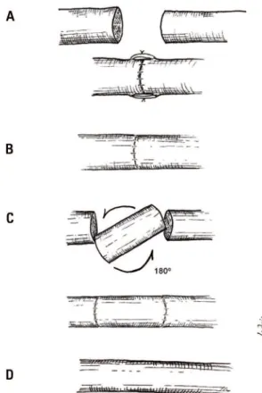 Fig 2.  Suture technique employed for each group (n partial=10,  n total=40) [A] Group 1: tension suture with epineural stitches  after resecting a nerve segment of 4 mm
