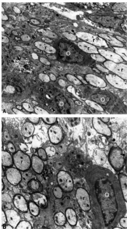 Fig 2. Group III - Electronmicrographs [A] Oligodendrocyte (O)  presenting extensive rough endoplasmic reticulum next to  remy-elinating axons (r) and astrocyte processes (a)