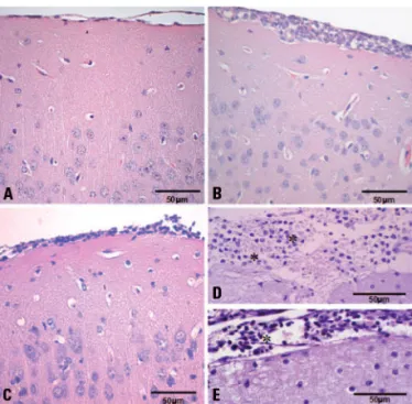 Fig 1. Histological changes in the brain after intracerebral inoc- inoc-ulation with 10 4  PFU of HSV-1 in C57BL/6 and IL-4 –/–  mice