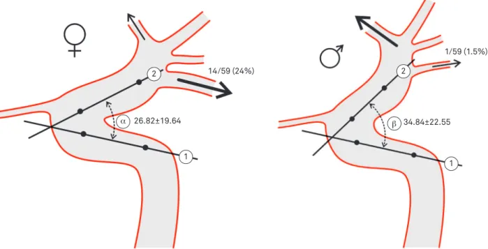 Fig 2. Aneurysms of the posterior and anterior communicating arteries in men and women.