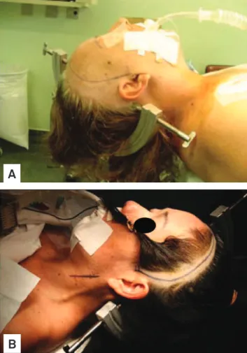 Fig 1. Positioning, trichotomy and marking of the incision: 