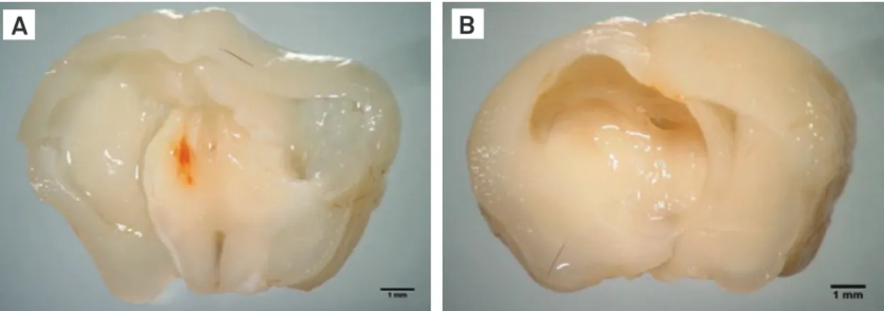 Fig 2. Mesosocopic image from encephala of BALB/c (A) and C57BL/6 (B) mice in a coronal section, presenting a cysticercus that  induced ventriculomegaly and deviation of the median line (scale=1 mm).