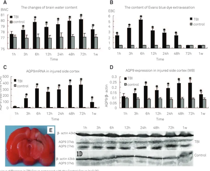 Fig 1. (A) The changes of brain water content; (B) The content of Evans blue dye extravasation; (C) Aquaporin-9 (AQP9)  mRNA expression in injured side cortex showed by real time polymerase chain reaction ; (D) AQP9 expression in injured side  cortex showe