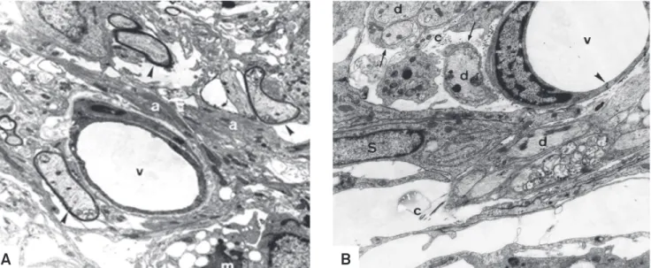 Fig 4. (A) Oligodendrocyte-remyelinated axons (arrowheads) near to a blood vessel (v) at 15 days after ethidium bromide injection
