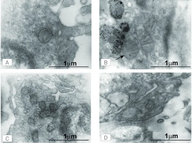 Fig 3. High-power electron microscopy photomicrographs showing smaller mitochondria in sporadic amyotrophic lateral sclerosis  (A, C) than in healthy controls (B, D)