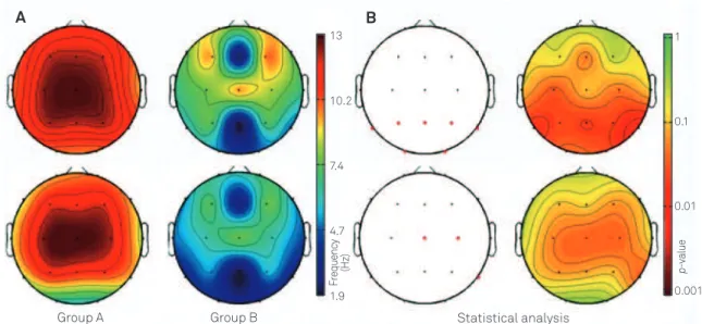 Figure 2. Examples of the power spectrum obtained from the EEG of patients with acute encephalopathy from Groups A and B