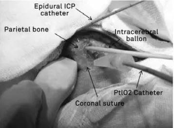 Figure 1. Figure of experimental model during the procedure. 