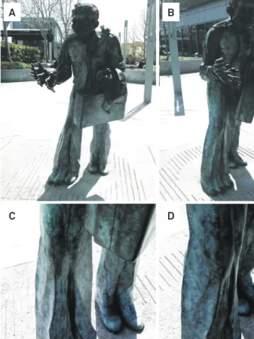 Fig 1. General overview of “The Shaking Man”, with front and  lateral views and closer look of his legs