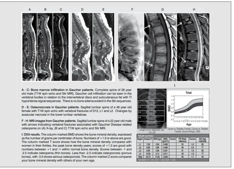 Figure 2. Radiological manifestations found in GD patients.