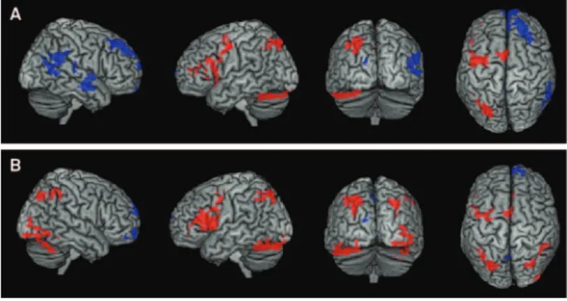 Figure 2. Brain regions with significant differences between the first and second fMRI sessions