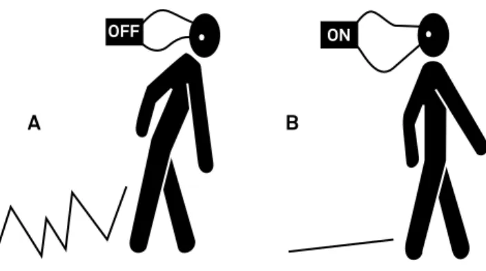 Figure 2. Electromyographic activity recorded in the right  sternocleidomastoid muscle before (left) and after (right)  intervention
