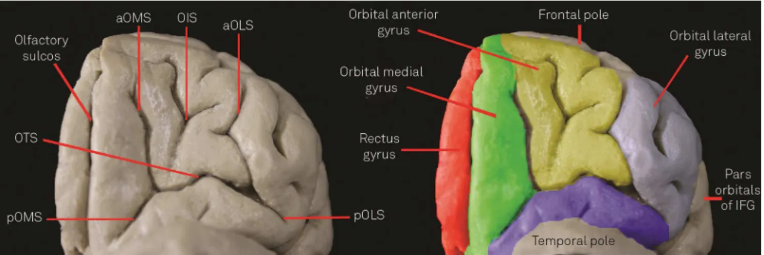 Figure 1. On the left, we expose the orbitofrontal cortex to characterize the sulcal pattern