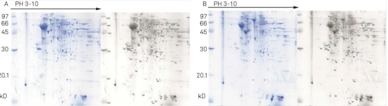 Figure 1. Proteomic analysis of sham-operated and traumatic brain injury (TBI) brain cortex using 2-DE.