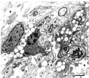 Figure 1. Electronmicrograph from a central area at 15 days  following ethidium bromide (EB) injection in rats not treated  with propentofylline (PPF)