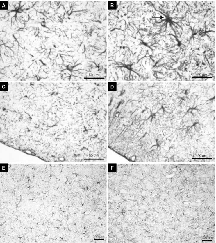 Figure 3. Peripheral glial ibrillary acidic protein (GFAP) expression by immunohistochemistry in the ventral surface of the  pons at 15 days (A, B), 21 days (C, D) and 31 days (E, F) in ethidium bromide (EB)-induced lesions from untreated (B, D, F) and  pr