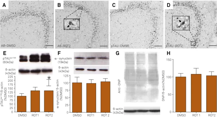 Figure 1. Illustrative digital images showing the pattern of amyloid-beta peptide (A β , A and B) and hyperphosphorylated  TAU (p-TAU, C and D) immunoreactivities in the hippocampus (CA3 region) of 10-month-old rats exposed to DMSO or  rotenone (2mg/kg/day