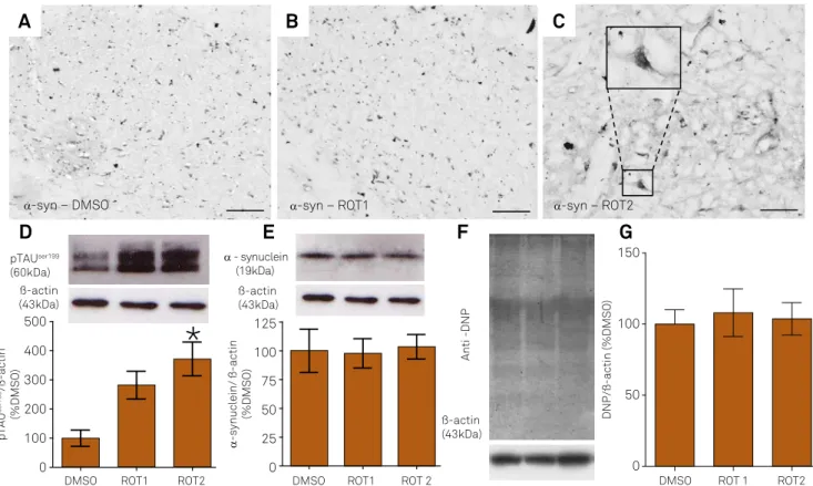 Figure 2. Illustrative digital images showing the pattern of alpha-synuclein ( α -syn) immunoreactivity in the substantia nigra  of 10-month-old rats exposed to DMSO (A) or rotenone (1 mg/kg/day, ROT1 (B) or 2 mg/kg/day, ROT2 (C))