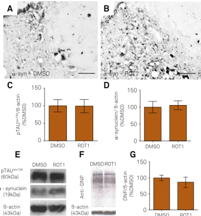 Figure 3. Illustrative digital images showing the pattern of alpha-synuclein (α-syn) immunoreactivity in the locus coeruleus  of 10-month-old rats exposed to DMSO (A) or rotenone 2 mg/kg/day, ROT2 (B))