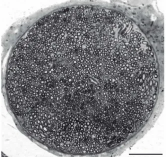 Figure 6. Transverse section through the distal level of a Wistar  rat fibular nerve. Images of the following structures can be seen: 