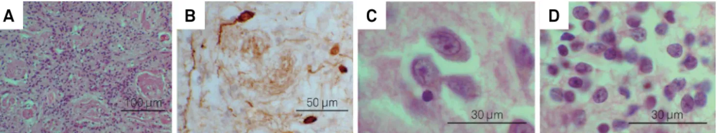 Figure 4. Illustrative photomicrographs showing: histology of glomerular layer (A) and periglomerular dopaminergic cells (B), and  appearance of large neurons in islands of the anterior olfactory nucleus inside the olfactory bulb (C), compared to the small